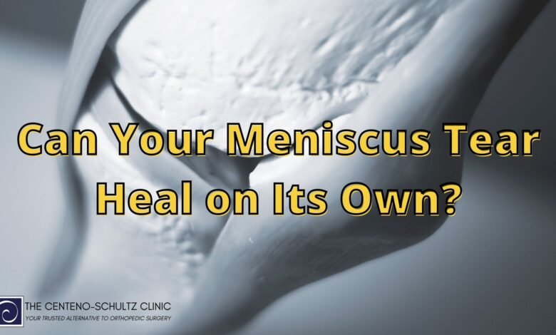 How to Heal a Torn Meniscus Naturally